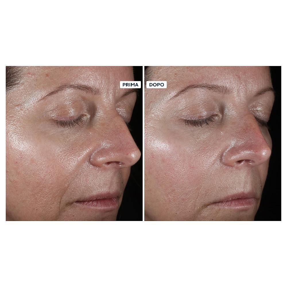 QVC Perricone MD Kit 4 prodotti viso: detergente idratante siero viso e occhi Grande vendita