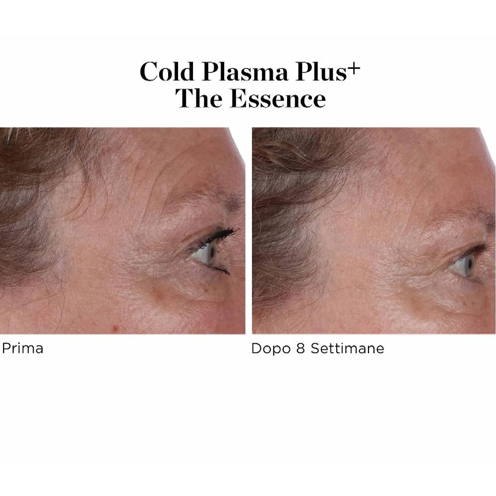 QVC Perricone MD Siero viso Cold Plasma Plus+ The Essence Saldi