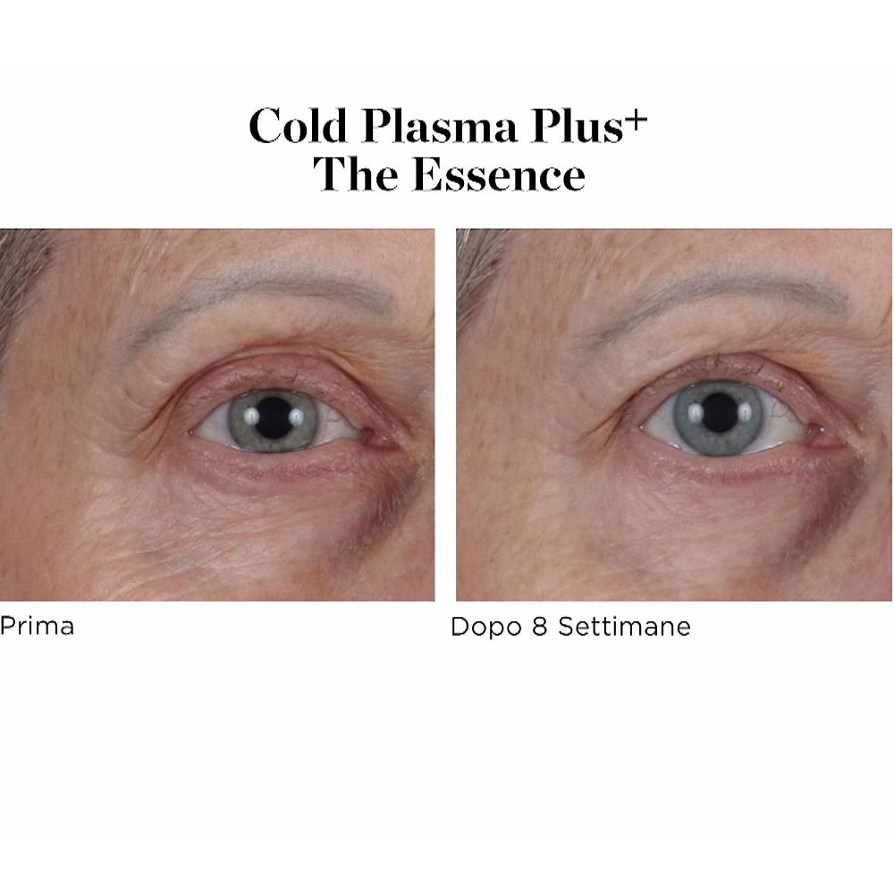 QVC Perricone MD Siero viso Cold Plasma Plus+ The Essence Saldi