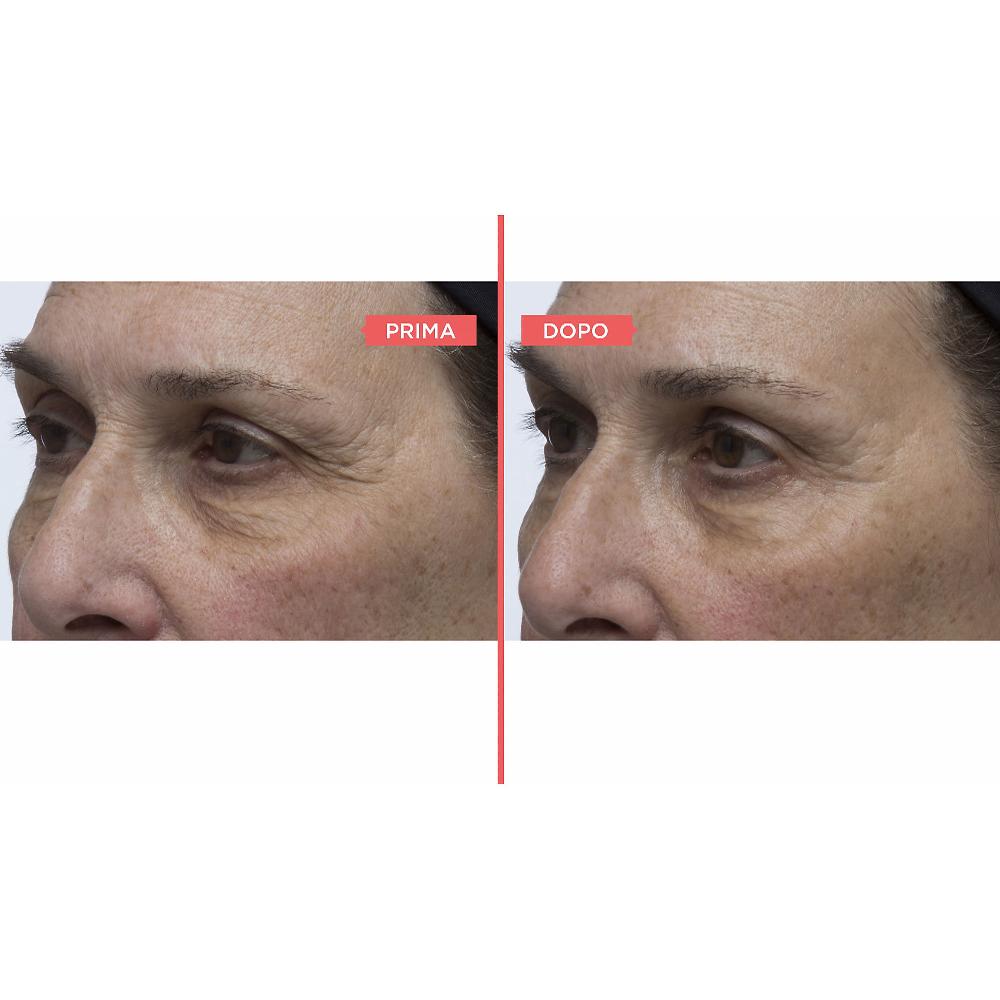 QVC Perricone MD Siero occhi Essential FX e mascara No Makeup 50% di sconto con spedizione gratuita