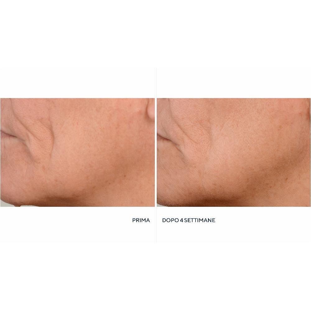 QVC Perricone MD Crema notte Essential FX + siero Firming&Lifting Economico