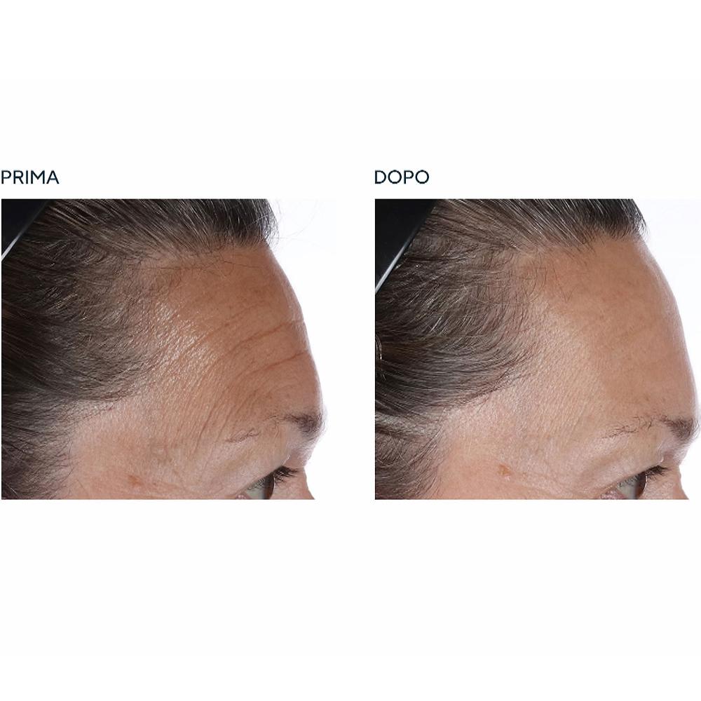 QVC Perricone MD 2 olii viso Essential Fx Acyl-Glutathione Chia Prezzo basso