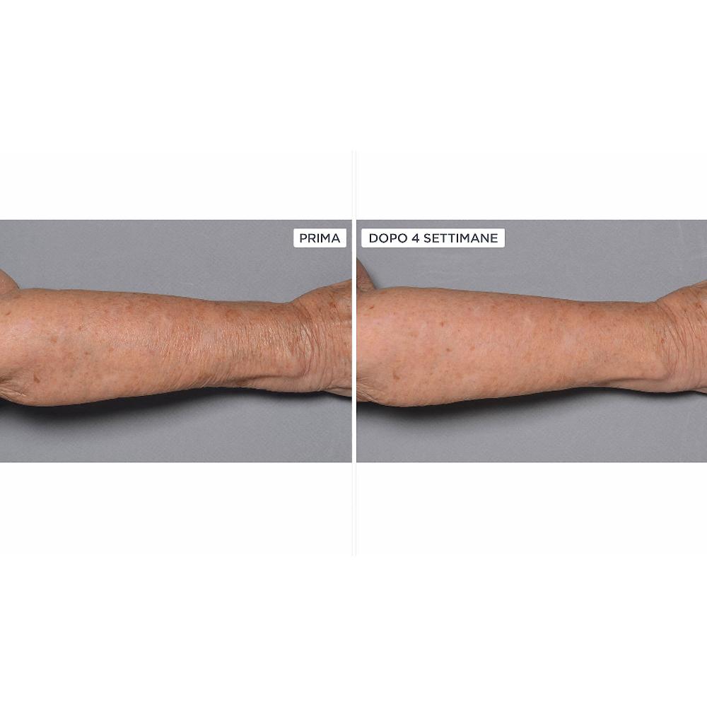 QVC Perricone MD Cold Plasma+Fragile Skin corpo 2pz Shopping Online