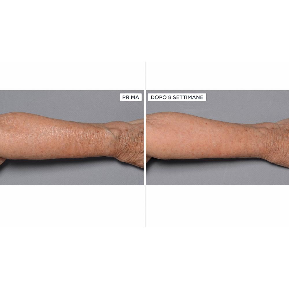 QVC Perricone MD Cold Plasma+Fragile Skin corpo 2pz Shopping Online