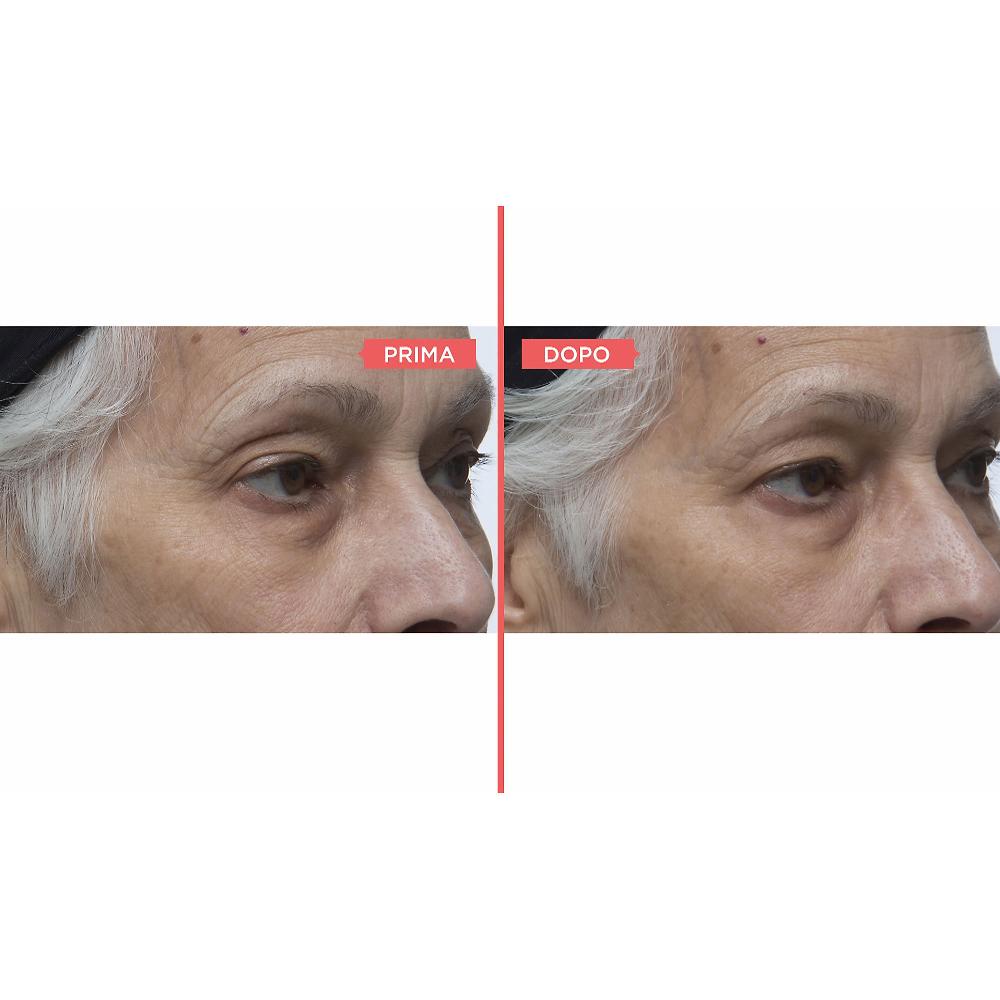 QVC Perricone MD Eyelid Serum Duo siero occhi antiossidante Comprane uno, ottenene uno gratis