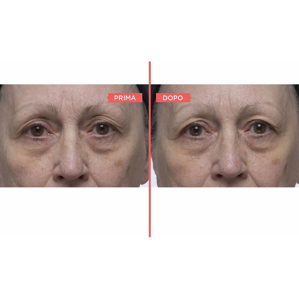 QVC Perricone MD Eyelid Serum Duo siero occhi antiossidante Comprane uno, ottenene uno gratis